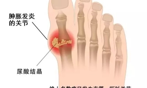 银杏叶片治疗耳鸣会越吃越严重吗-【银杏叶丸对耳鸣有效果吗怎么服用】银杏叶滴丸治耳鸣有效吗 - 银杏叶丸对耳鸣有效果吗网